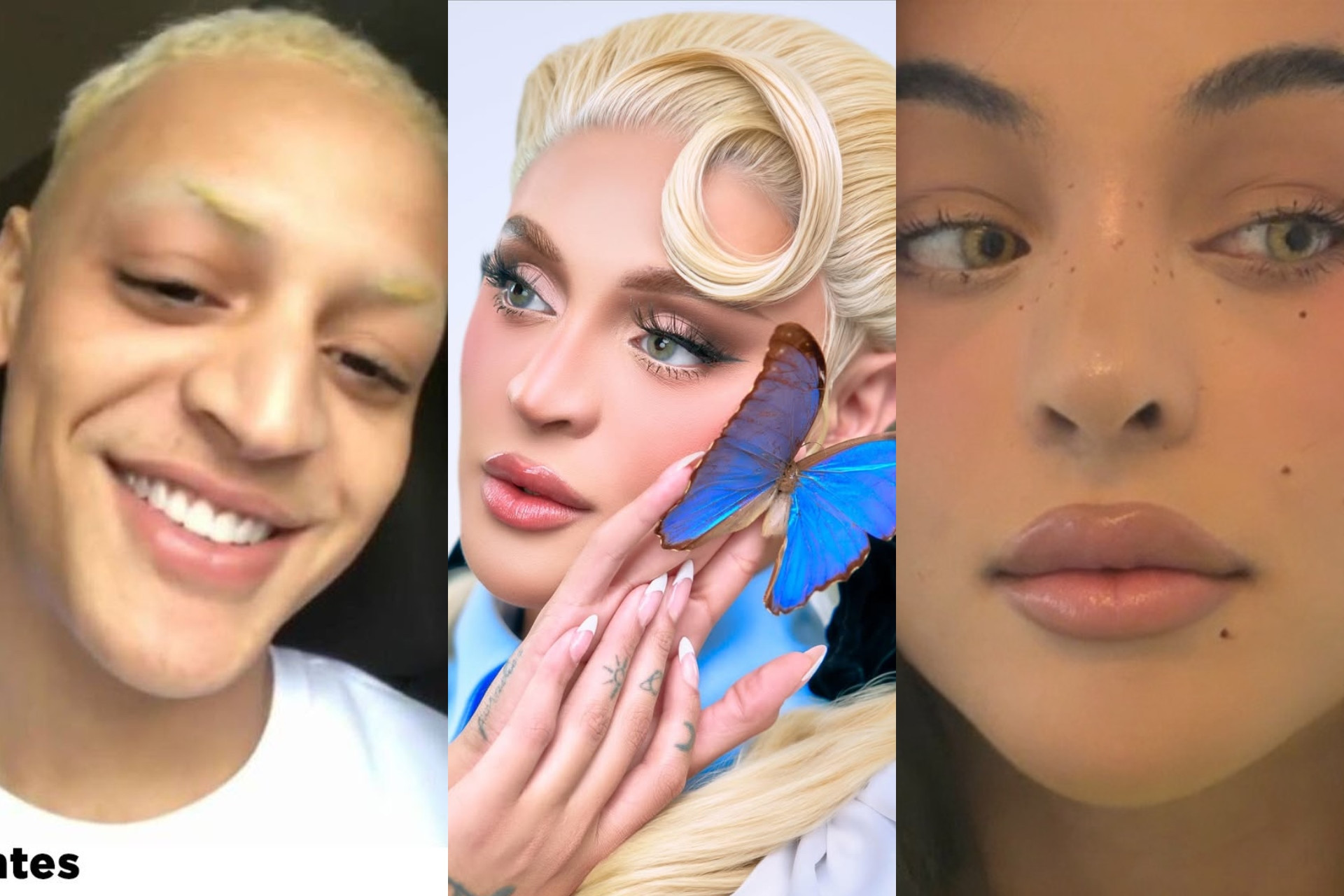 Veja antes e depois das três rinoplastias de Pabllo Vittar - Reprodução / Instagram