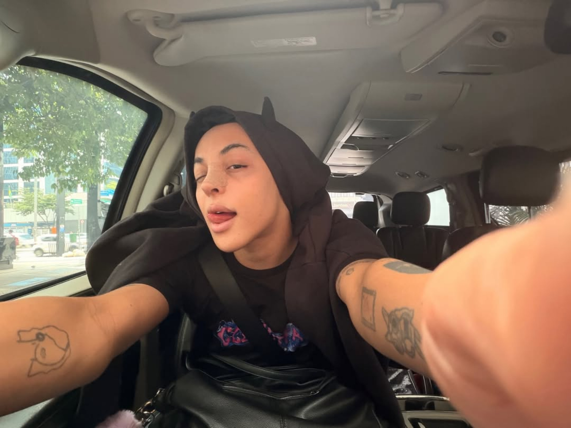 Pabllo Vittar passa por terceira rinoplastia - Reprodução / Instagram