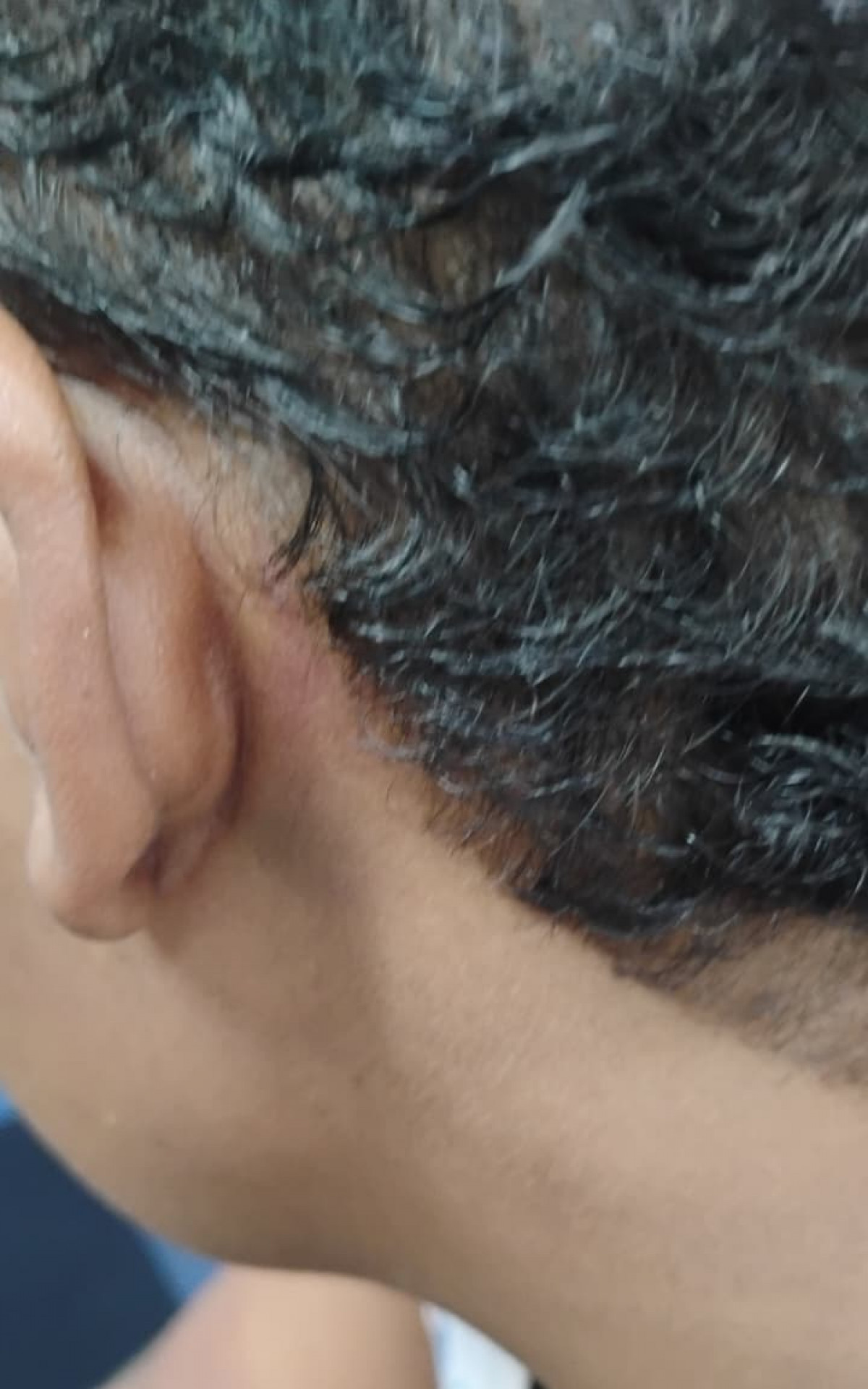 A vítima teve o cabelo cortado, foi mordida e agredida diversas vezes - Divulgação