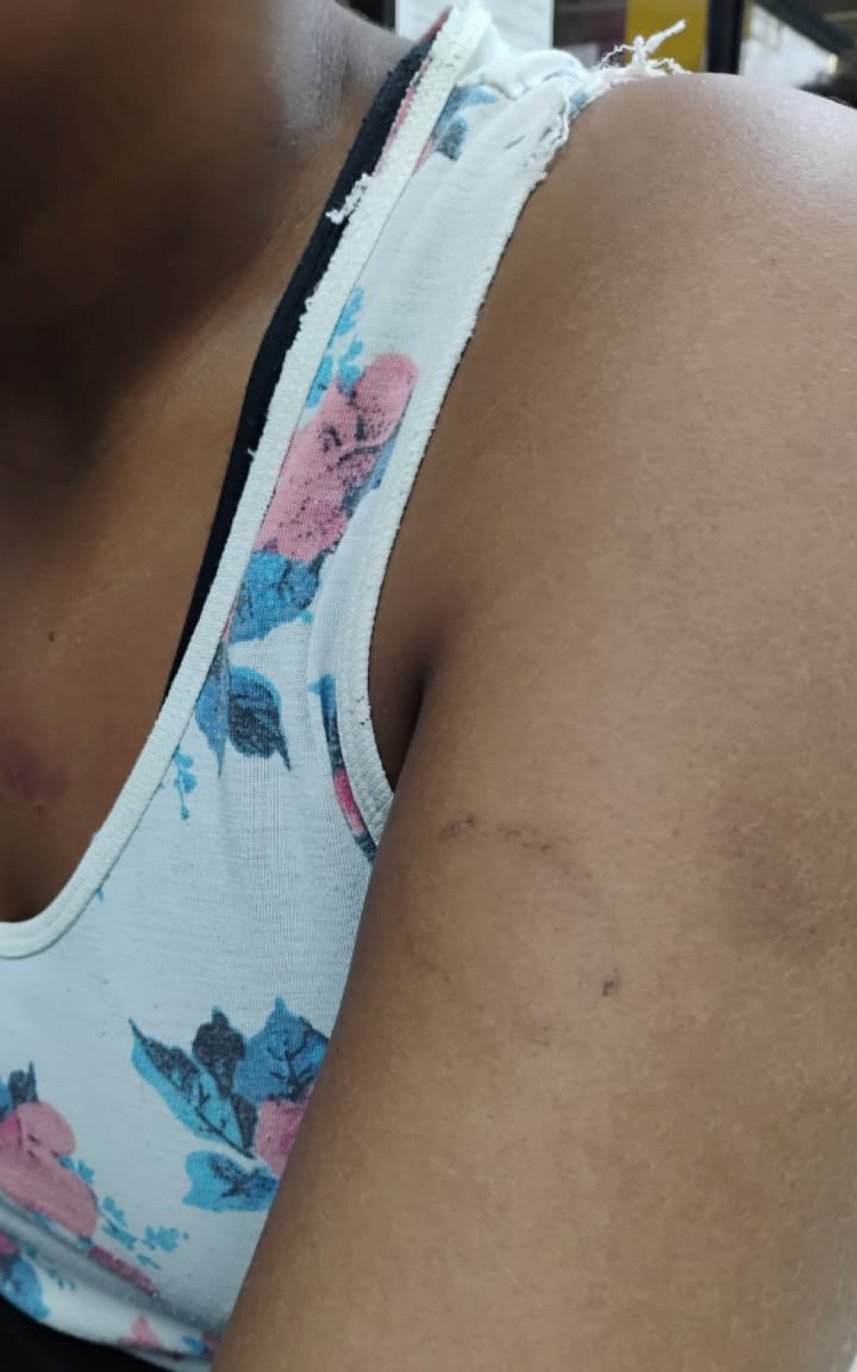 A vítima teve o cabelo cortado, foi mordida e agredida diversas vezes - Divulgação