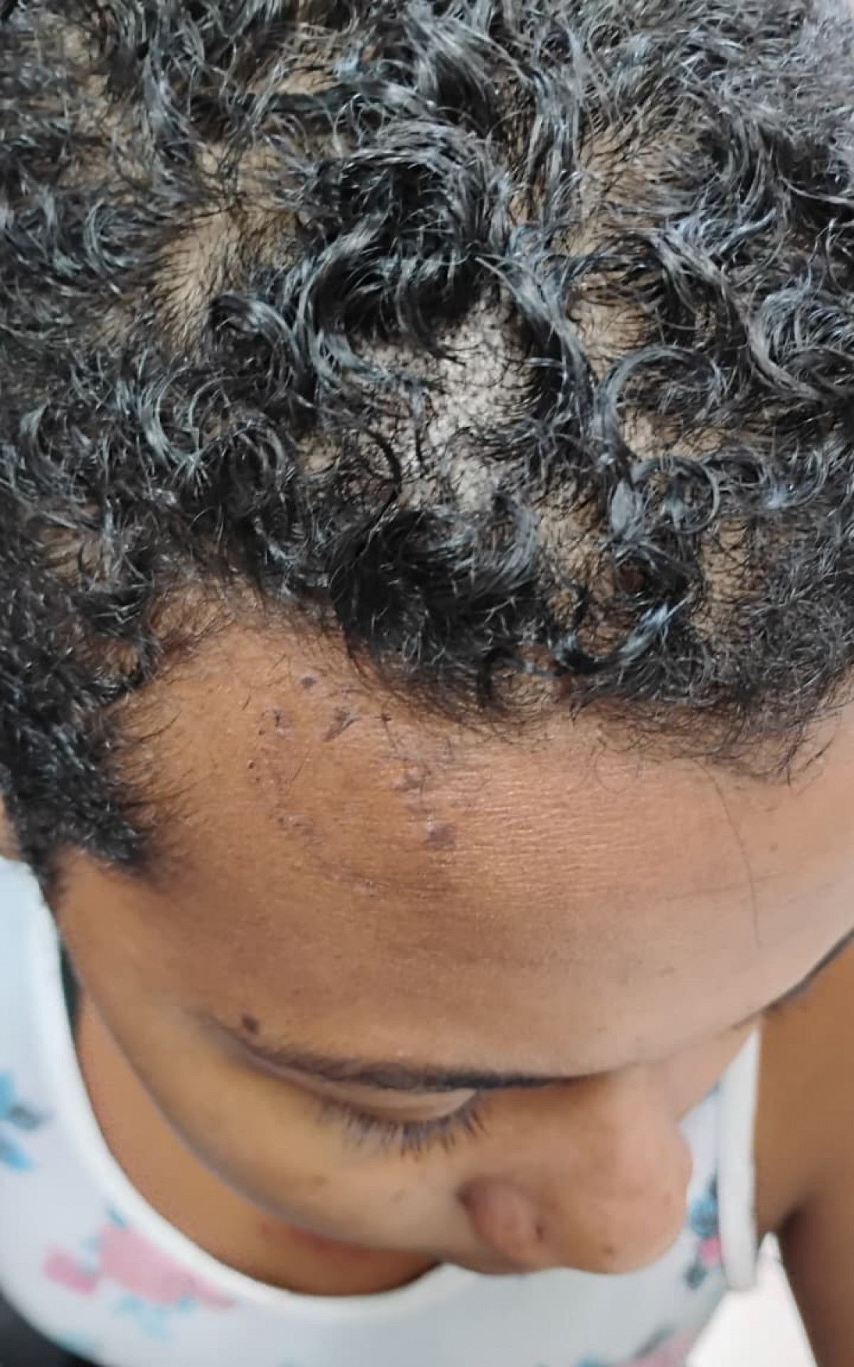 A vítima teve o cabelo cortado, foi mordida e agredida diversas vezes - Divulgação