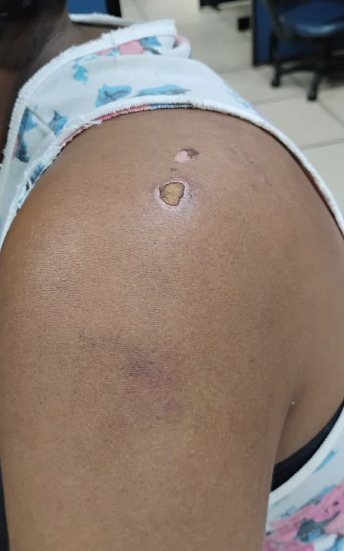 A vítima teve o cabelo cortado, foi mordida e agredida diversas vezes - Divulgação