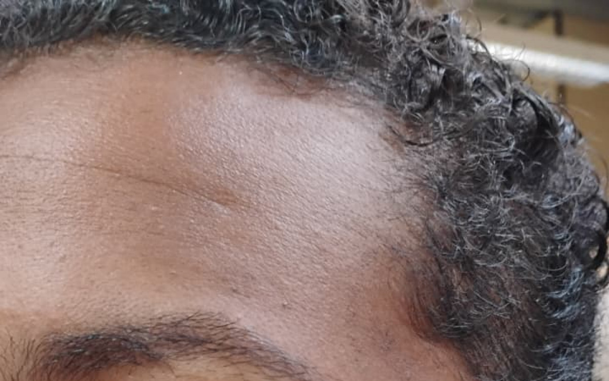 A v&iacute;tima teve o cabelo cortado, foi mordida e agredida diversas vezes