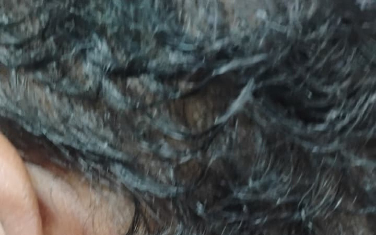 A v&iacute;tima teve o cabelo cortado, foi mordida e agredida diversas vezes