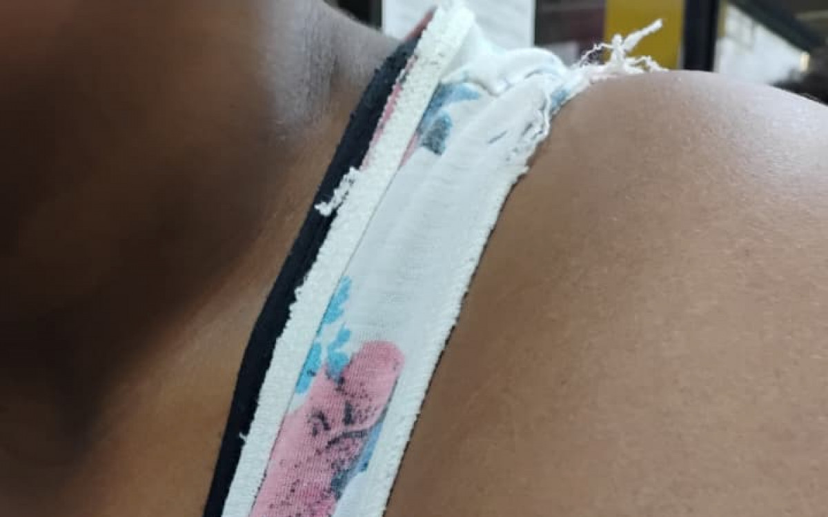 A v&iacute;tima teve o cabelo cortado, foi mordida e agredida diversas vezes