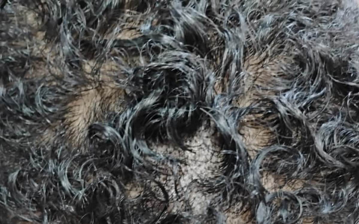 A v&iacute;tima teve o cabelo cortado, foi mordida e agredida diversas vezes