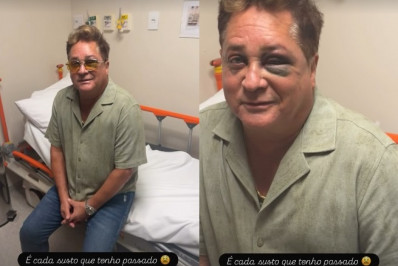 Leonardo sofre acidente em pescaria e surge com hematoma