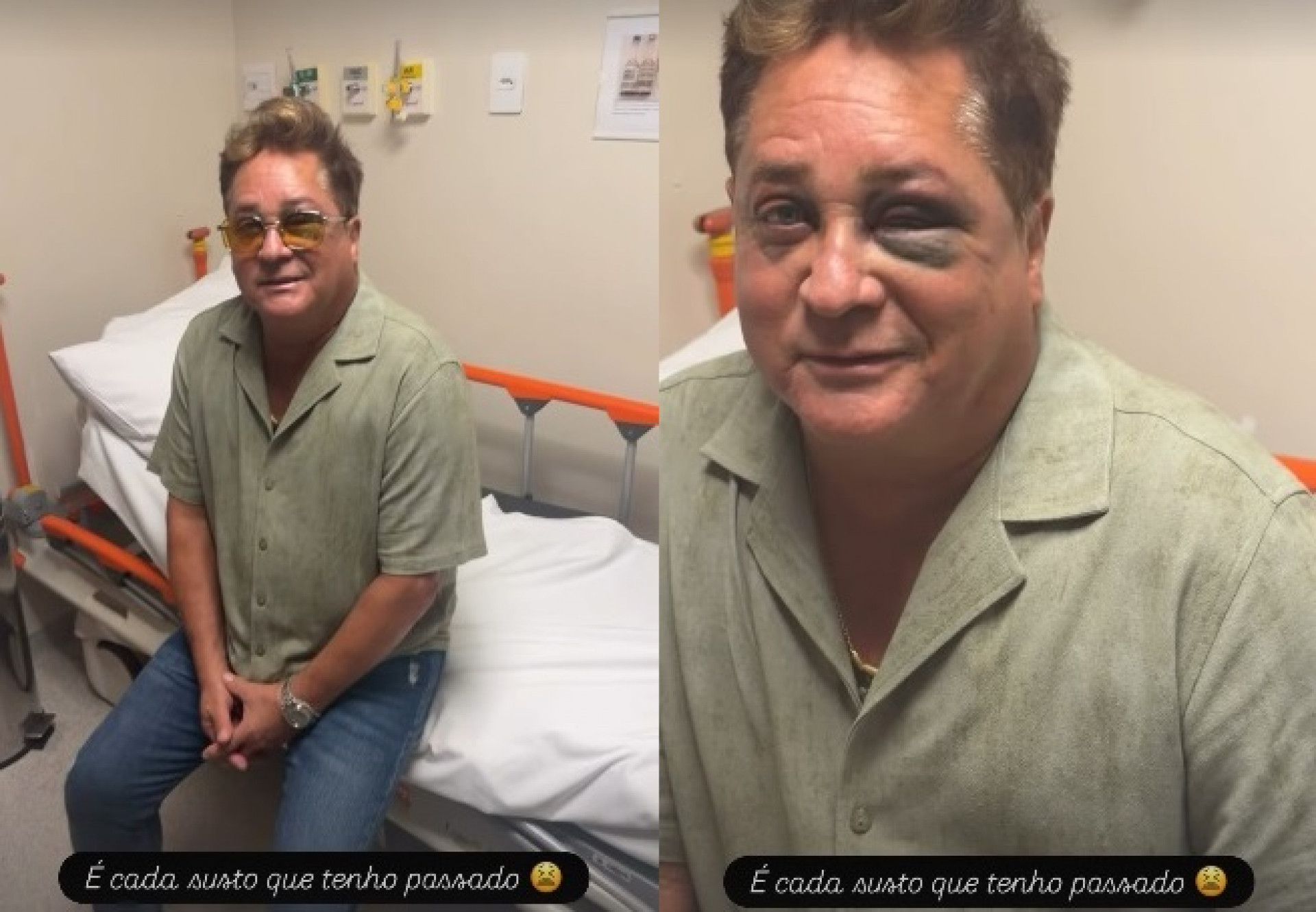 Leonardo surgiu com olho roxo após acidente em pescaria  - Reprodução/Instagram 