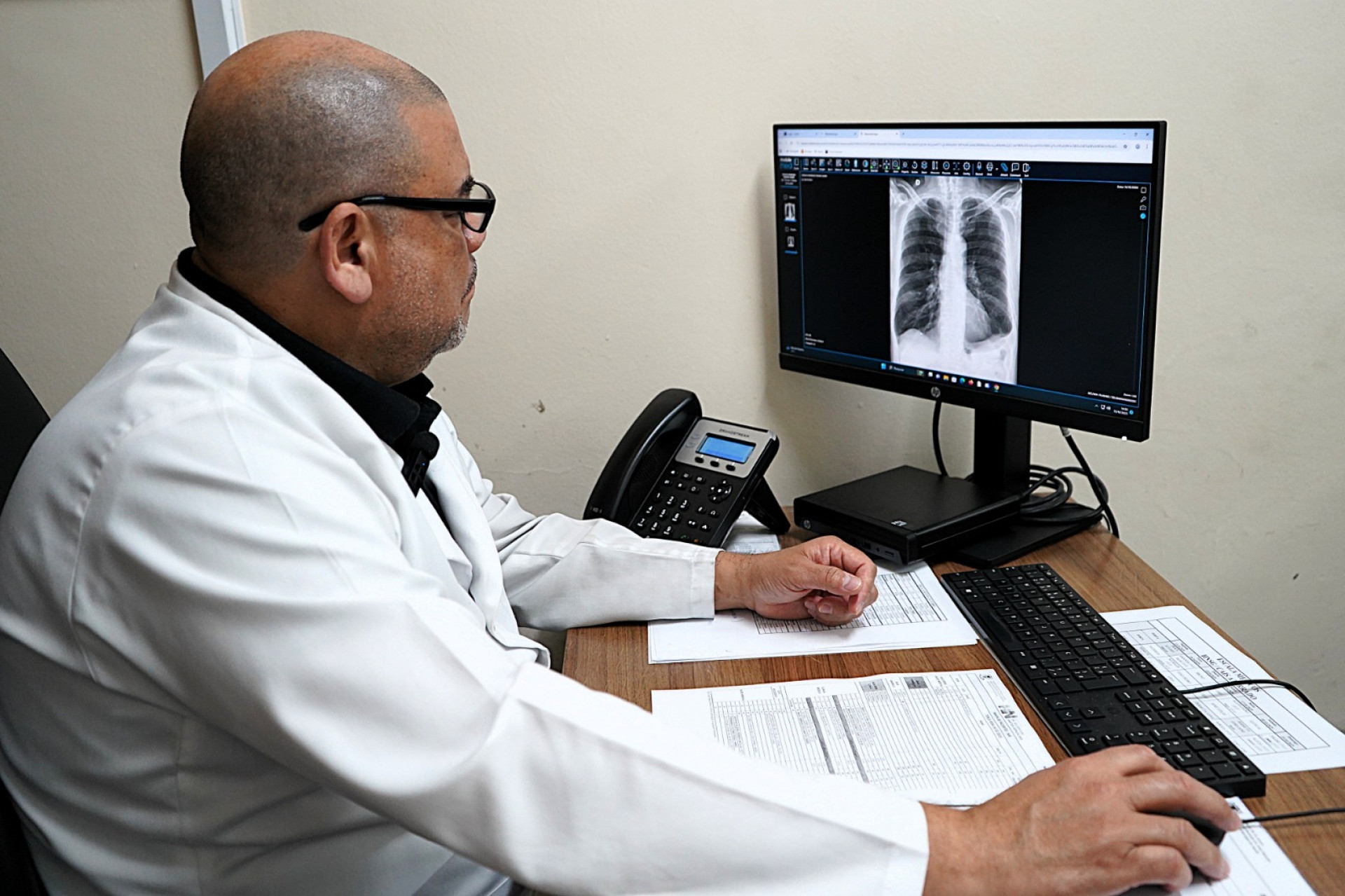 Saúde pública de Volta Redonda ultrapassa 50 mil exames analisados com auxílio da Inteligência Artificial