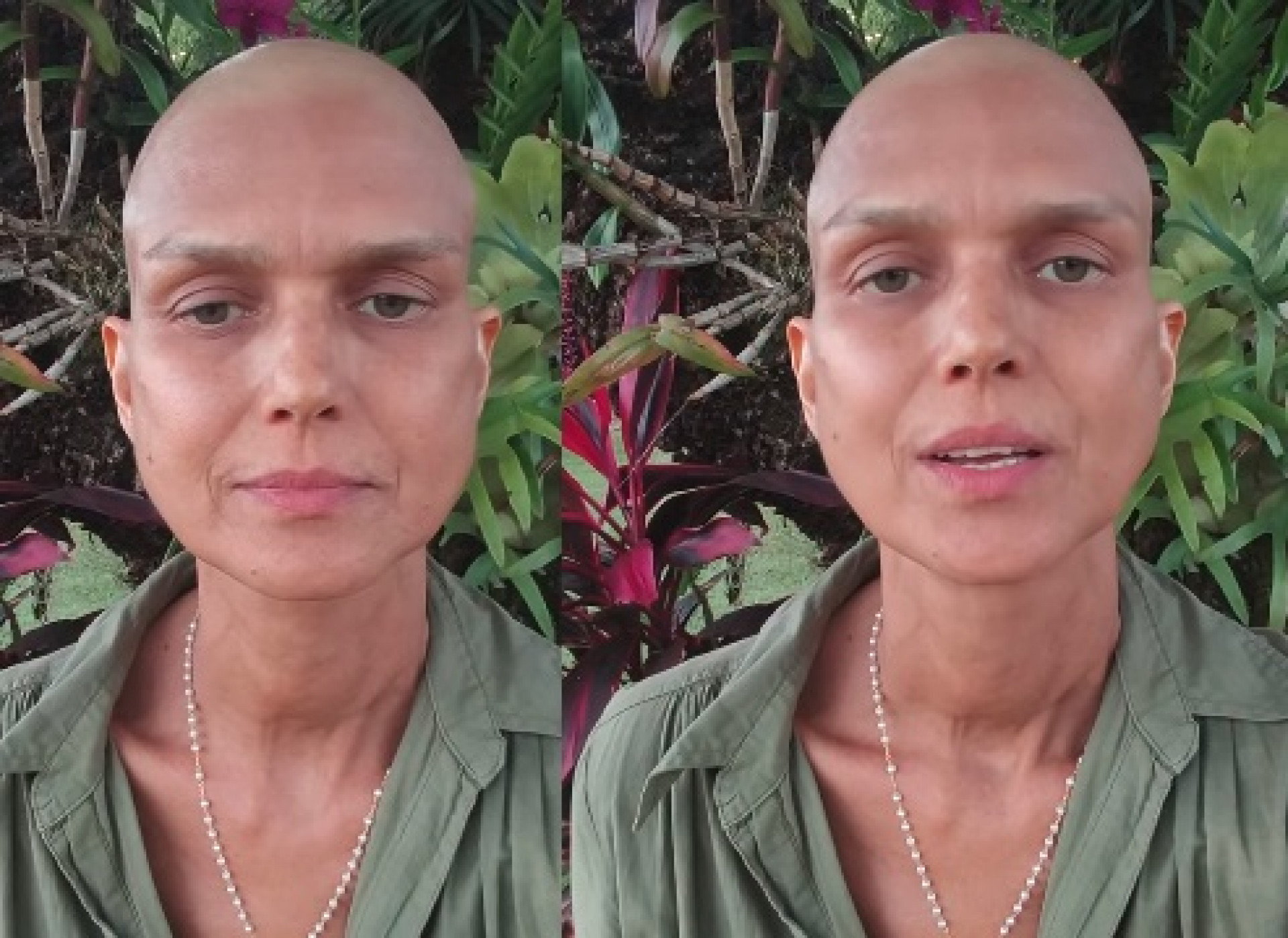 Ex participante do 'The Voice Brasil' nega golpe e pede ajuda para custear tratamento contra o câncer