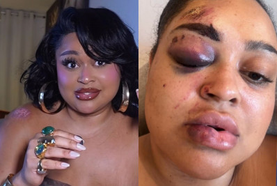 Ex-BBB Rízia Cerqueira relata perda de memória após acidente