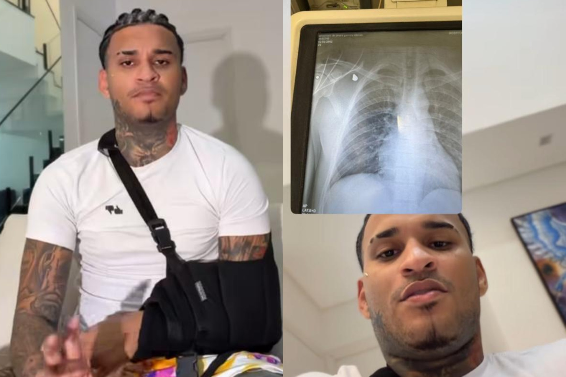 Anderson Neiff detalha emboscada e reação após ser atingido por disparo