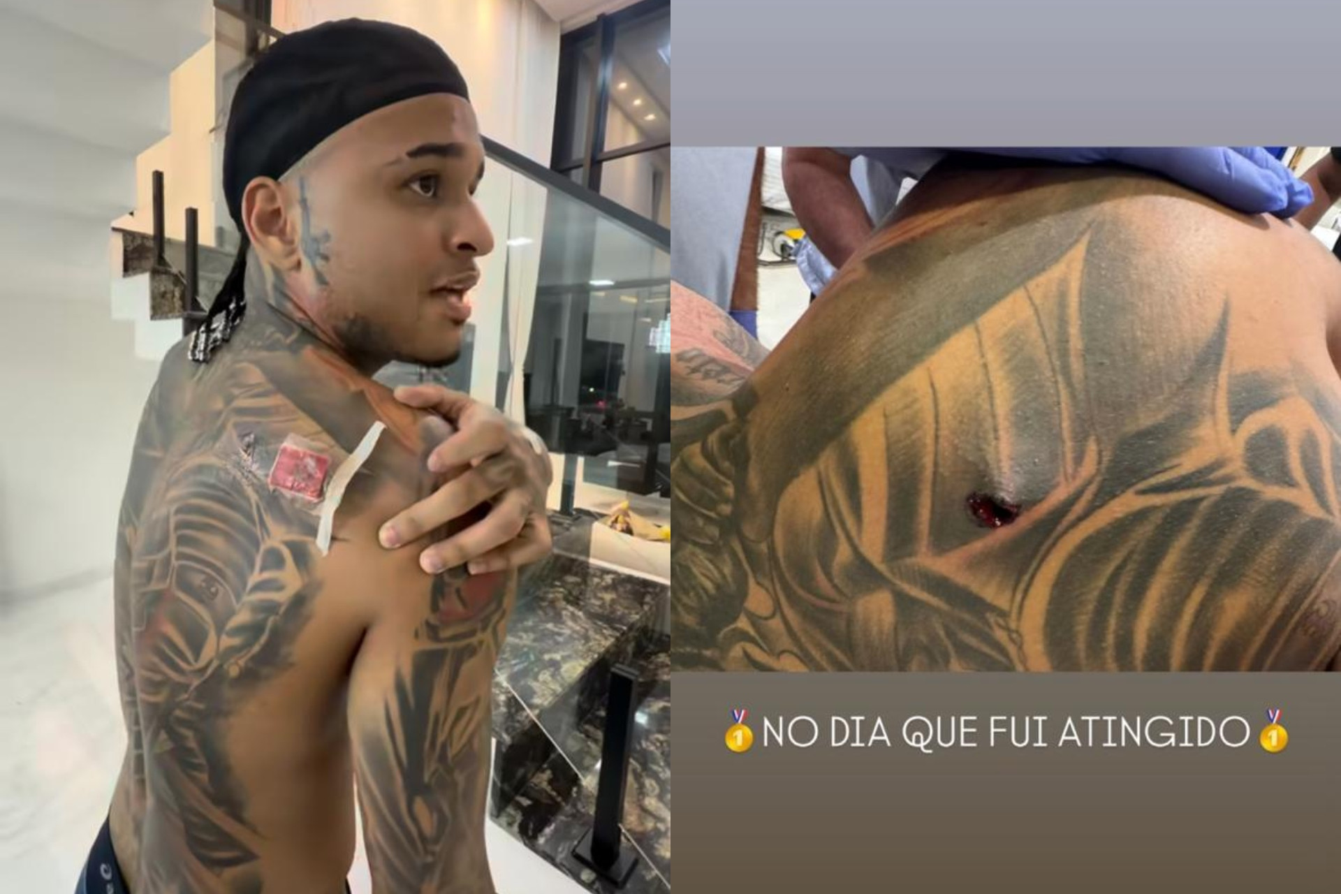 Anderson Neiff mostra onde foi baleado - Reprodução / Instagram