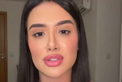 Vídeo: Ex-BBB Jordana abre o jogo procedimento na boca: 'Virou polêmica'