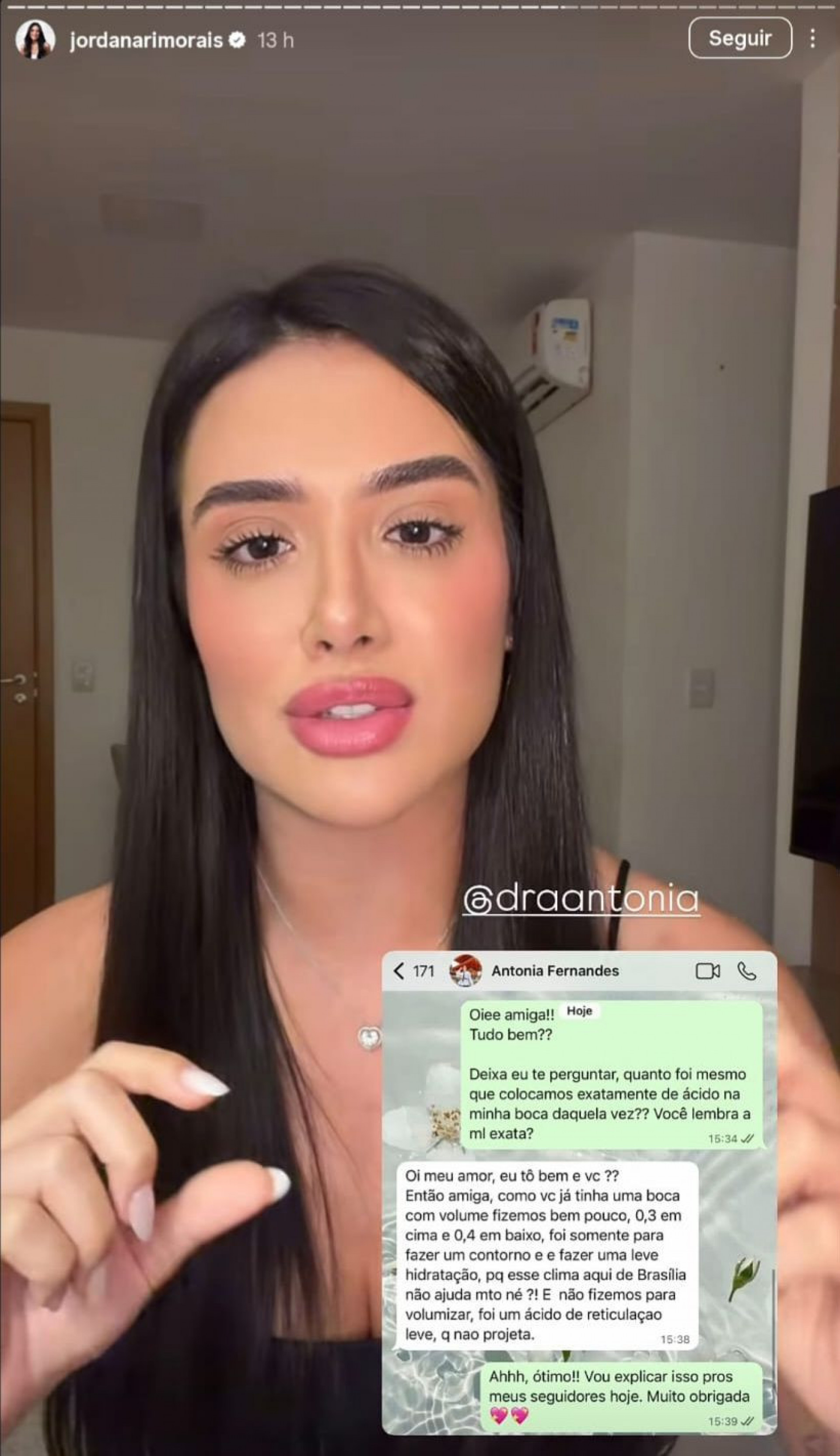 Ex 'bbb' Jordana, em story do Instagram, mostrando conversa com esteticista sobre procedimento nos lábios - Reprodução / Instagram