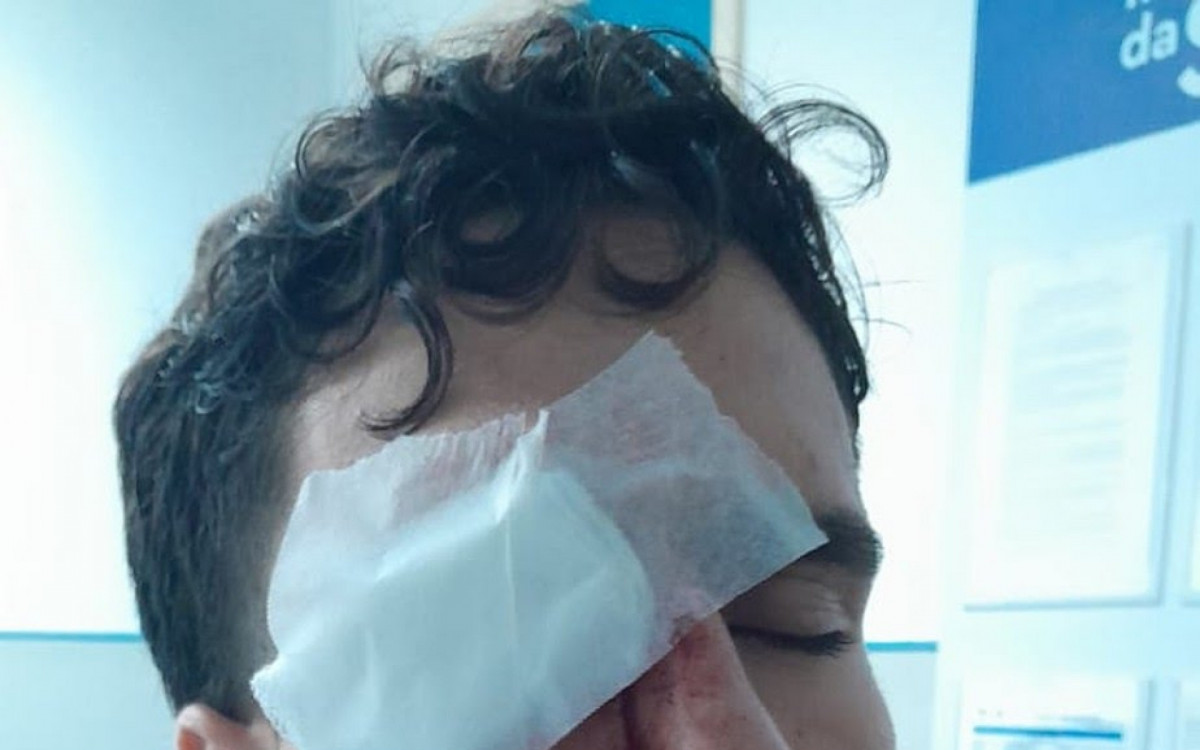 Arthur Cortines Laxe Ferreira da Conceição foi atingido no rosto enquanto tentava deixar o local.  - Arquivo pessoal