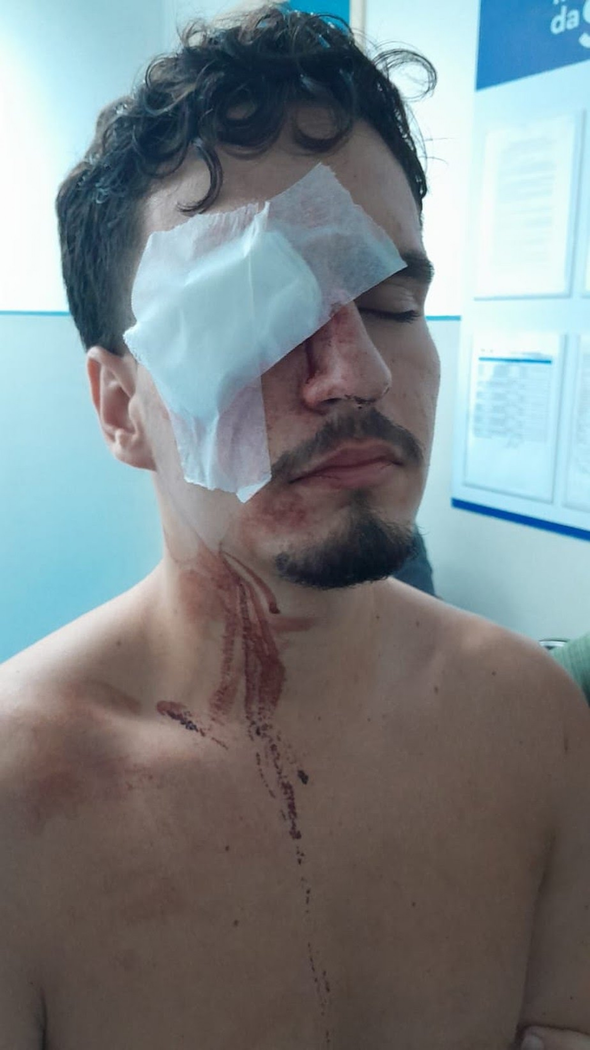 Jovem pode perder a visão após ser atingido por bala de borracha no entorno do Maracanã