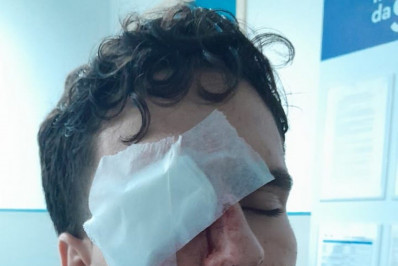 Jovem pode perder a visão após ser atingido por bala de borracha no entorno do Maracanã