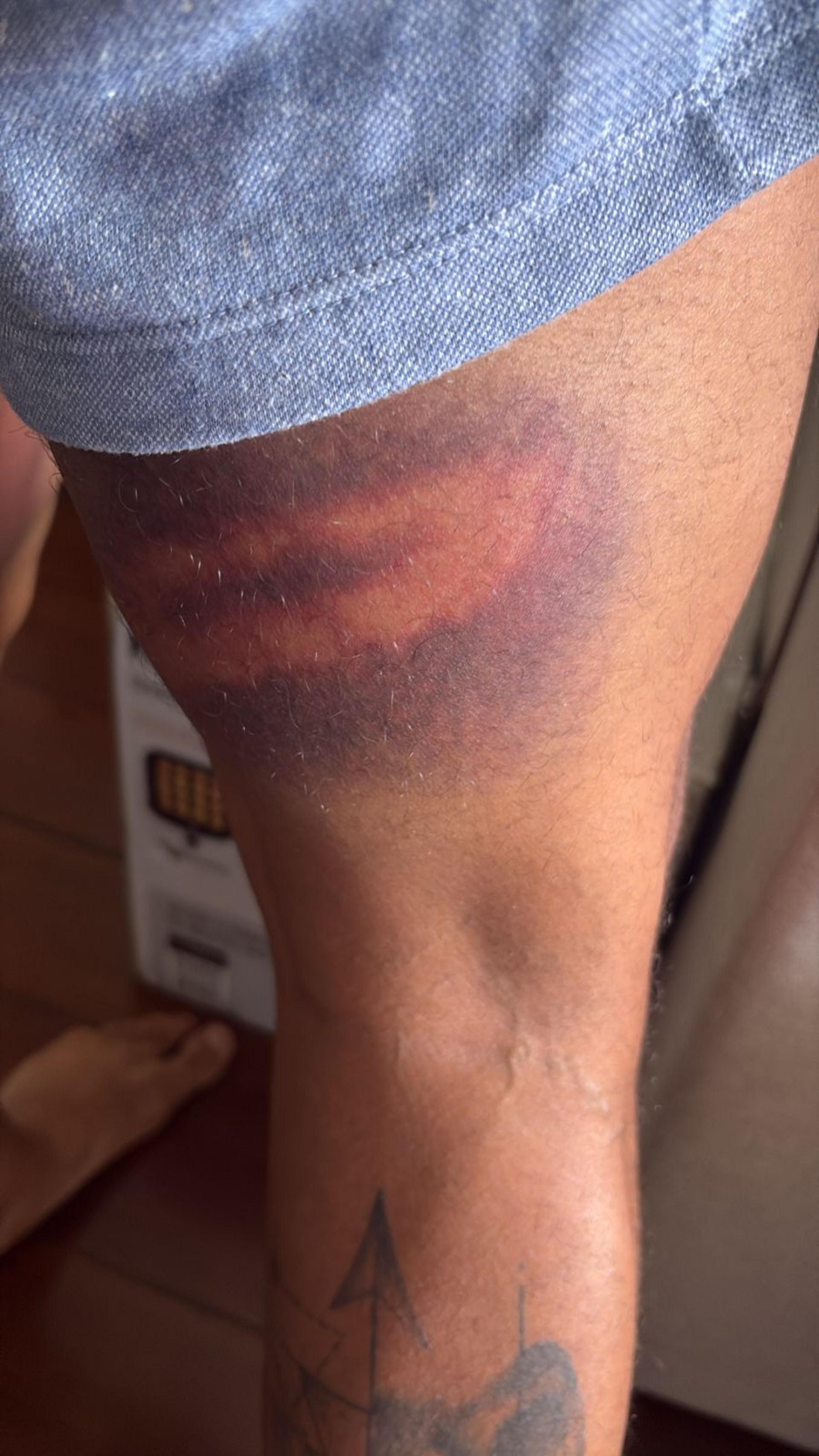 Vereador acusou PMs de agressão - Reprodução