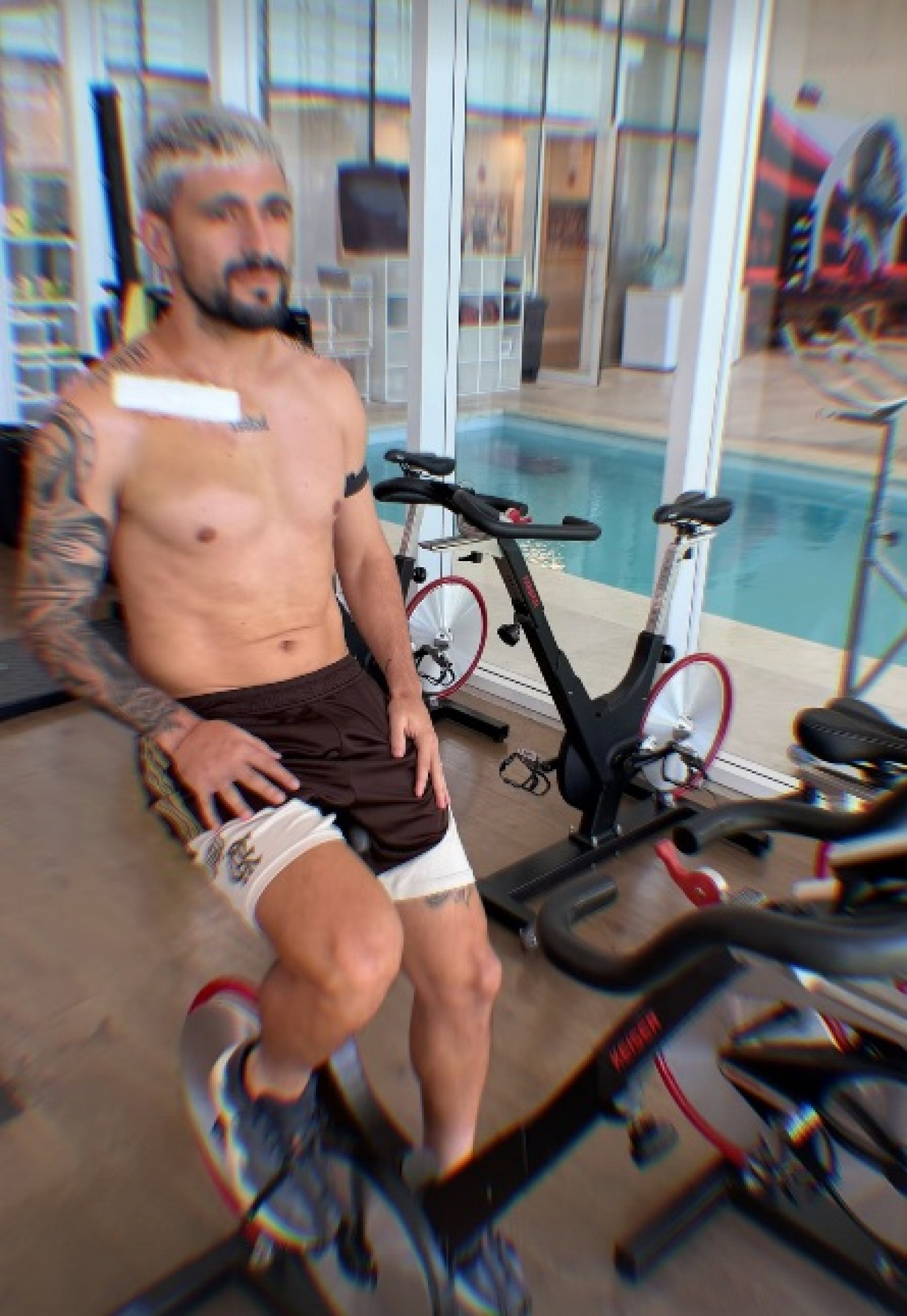 Arrascaeta faz a recuperação de cirurgia na clavícula no CT do Flamengo - Reprodução de Instagram