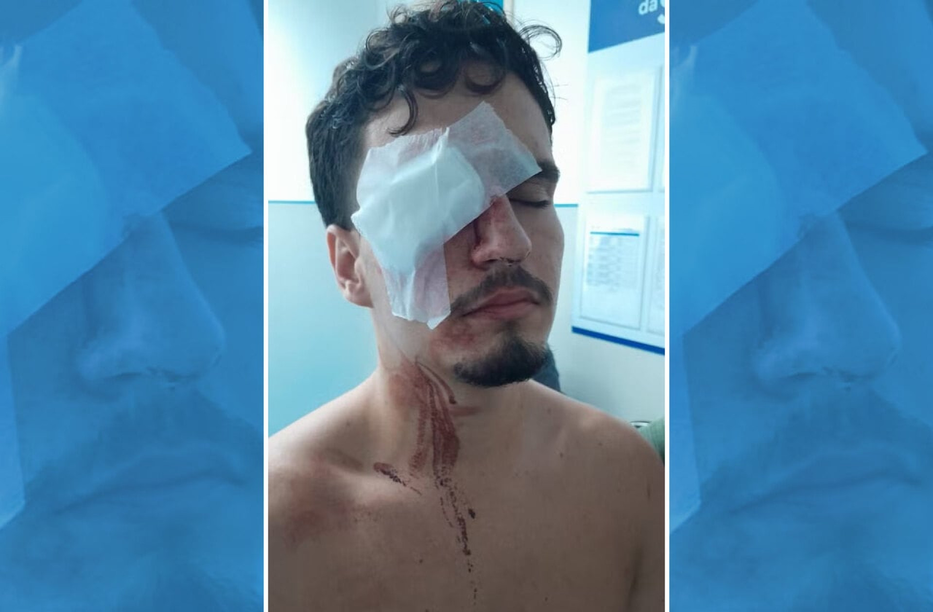 Alerj cobra investiga&ccedil;&atilde;o ap&oacute;s torcedor do Vasco perder vis&atilde;o em a&ccedil;&atilde;o policial