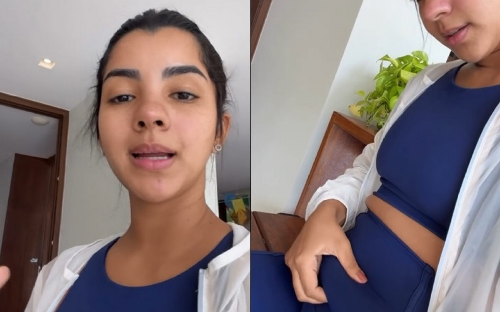 Diástase abdominal: Ary Mirelle mostra 