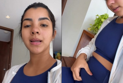Diástase abdominal: Ary Mirelle mostra 