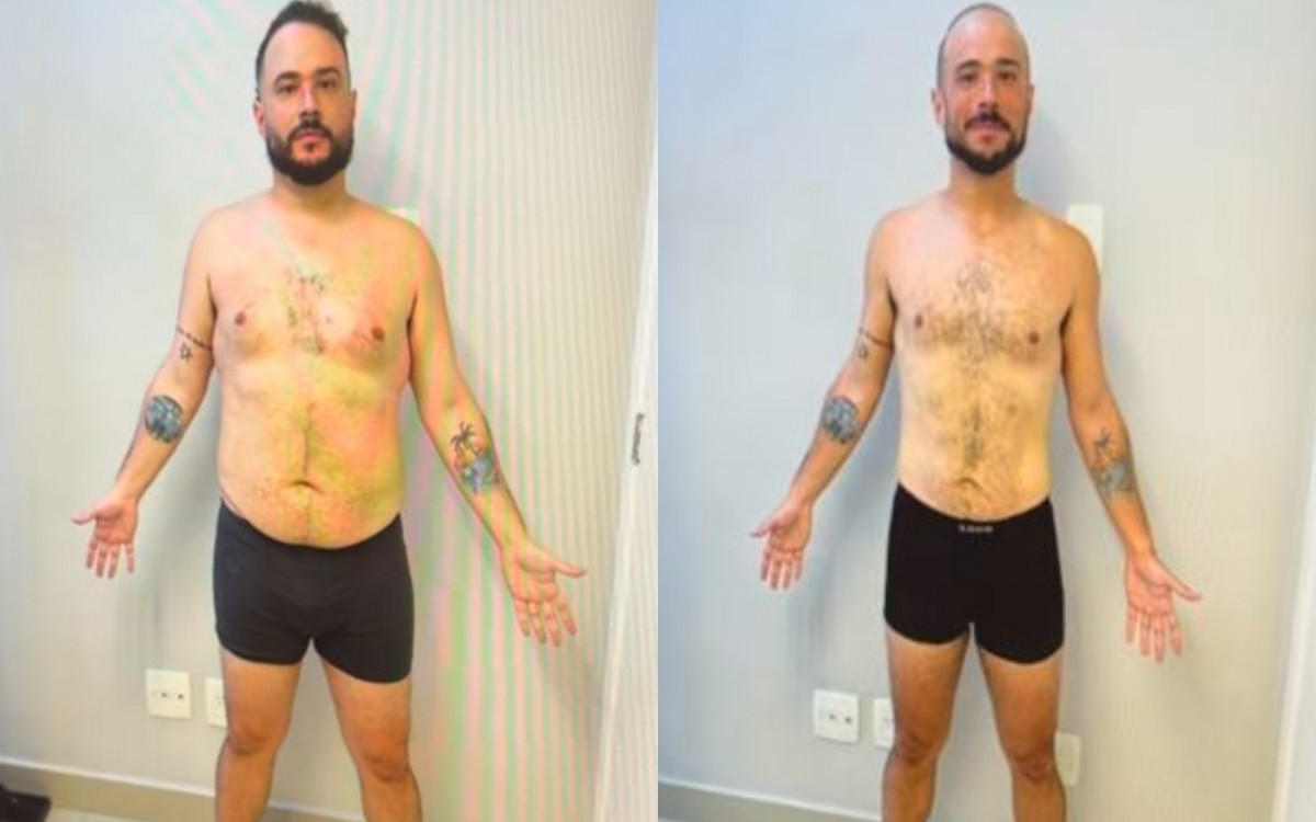 Antes e depois de Ed Gama perder 33 kg