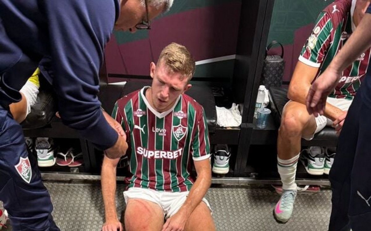 Veja como ficou a perna de Castillo ap&oacute;s dividida em jogo do Fluminense