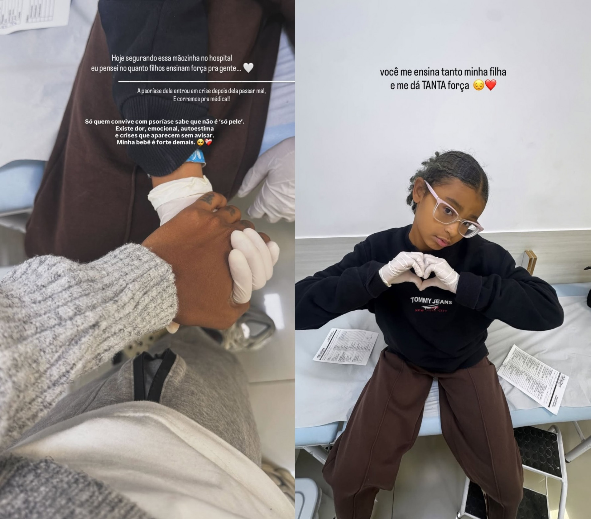 Vitória, filha de Pocah, foi ao hospital com crise de psoríase - Reprodução/Instagram