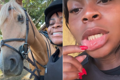Jojo Todynho relata acidente com cavalo e mostra ferimentos