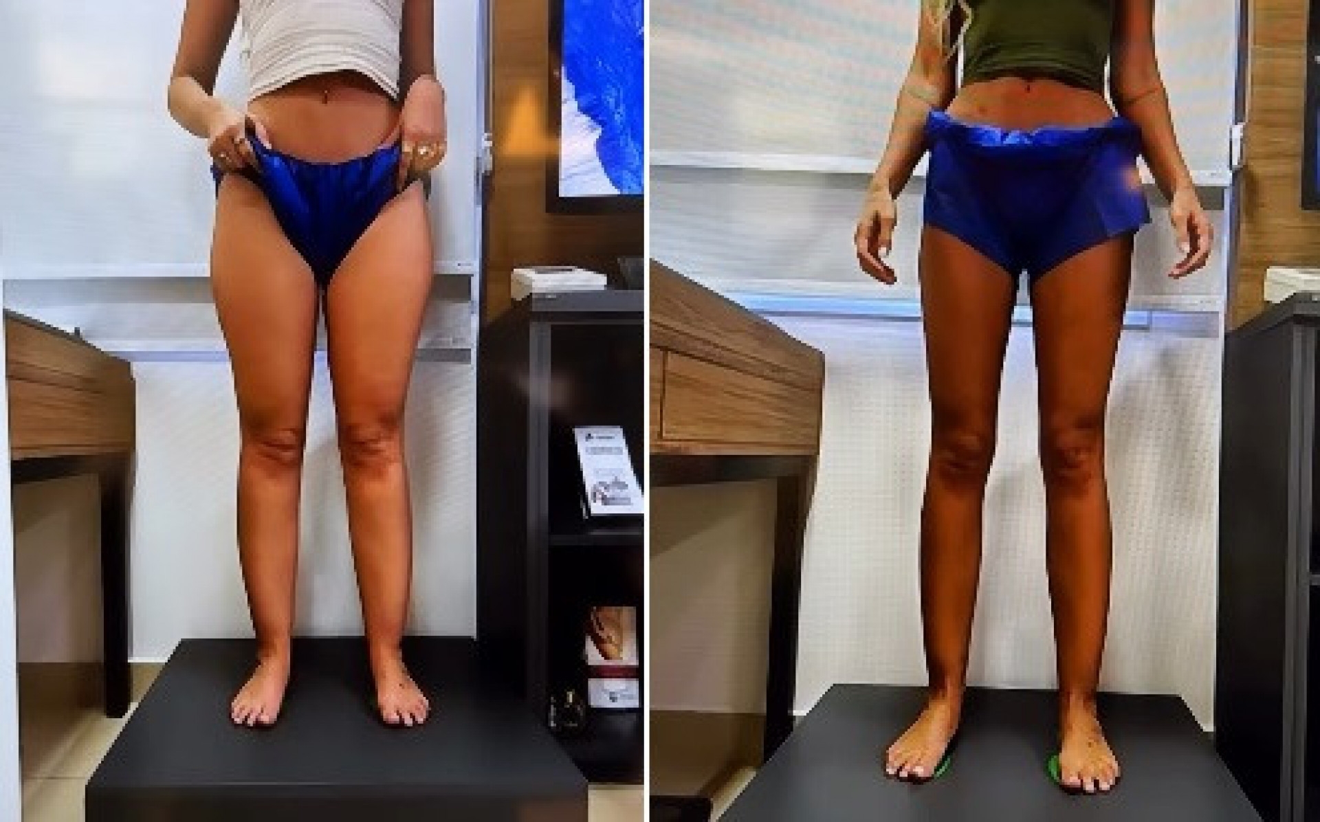 Yasmin Brunet mostra antes e depois após perder 25 kg - Reprodução/Instagram