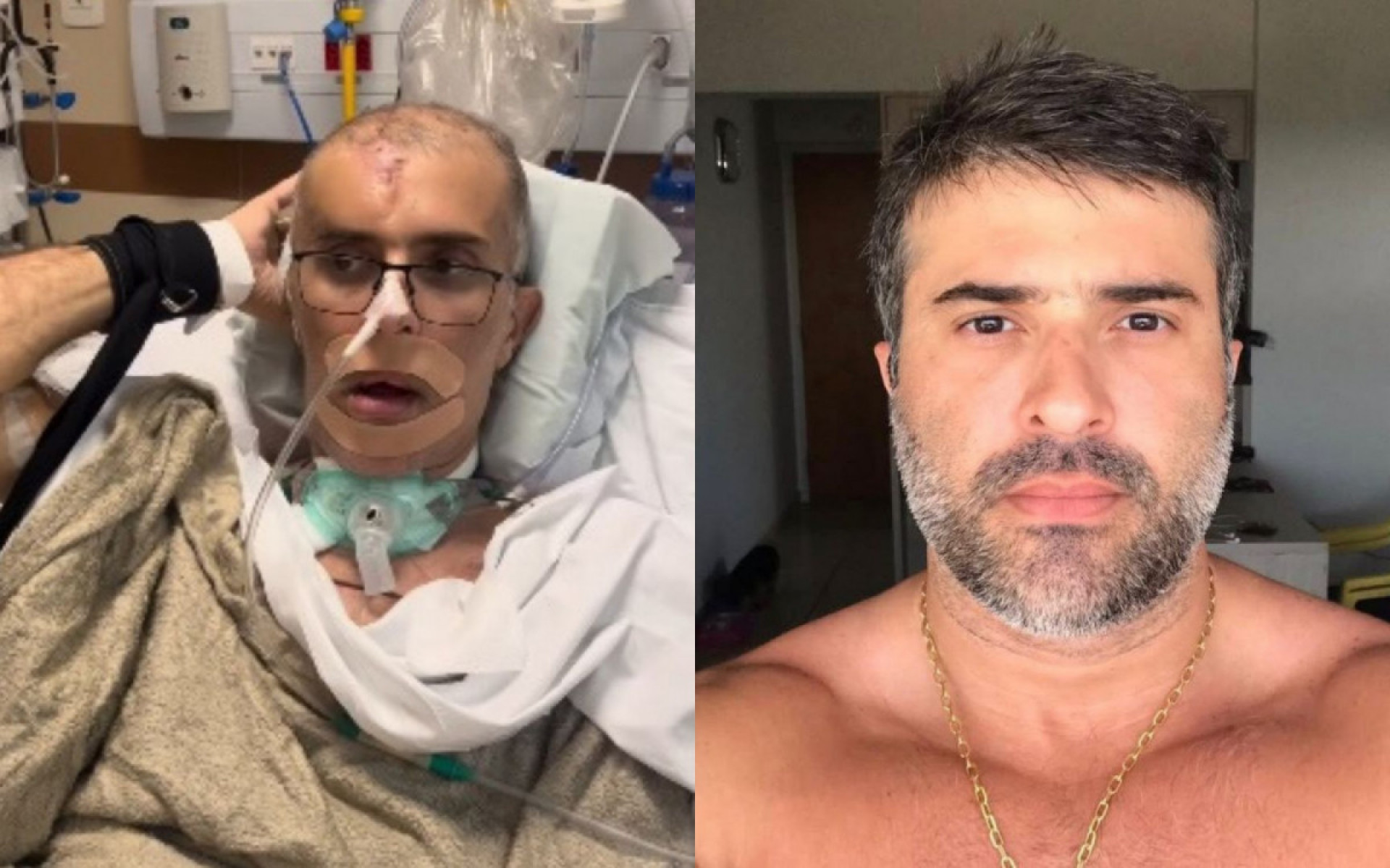 Felipe Monteiro fez v&aacute;rias cirurgias, mas acabou morrendo