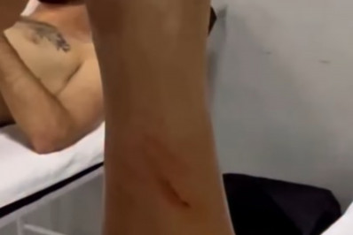 Vídeo! Flamengo exibe canela ferida de Paquetá e contesta arbitragem