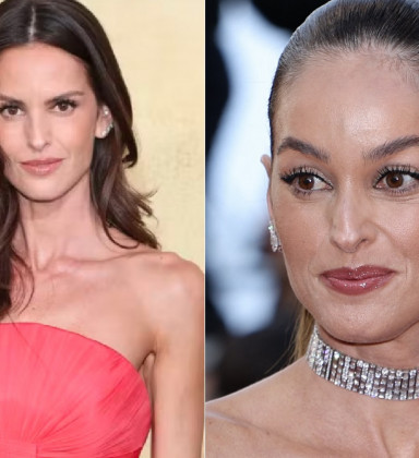 Izabel Goulart surge com rosto diferente e impressiona internautas