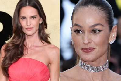 Izabel Goulart surge com rosto diferente e impressiona internautas