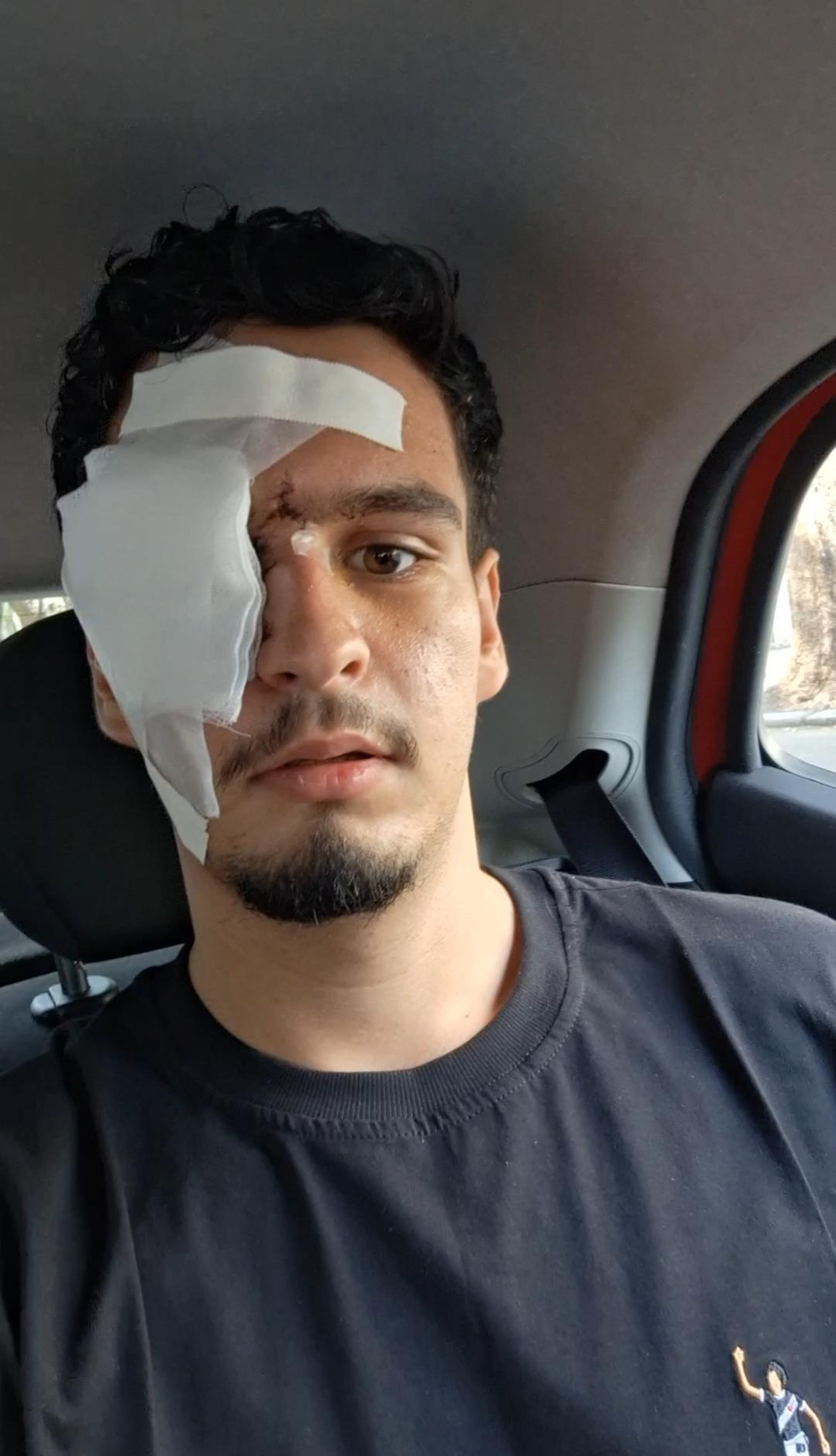 'Hoje o meu maior sonho é voltar a enxergar' diz jovem atingido por bala de borracha após clássico