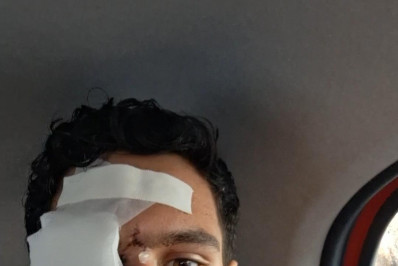 'Hoje o meu maior sonho é voltar a enxergar' diz jovem atingido por bala de borracha após clássico