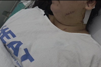 Empresária é esfaqueada pelo marido e é socorrida pela amante do suspeito