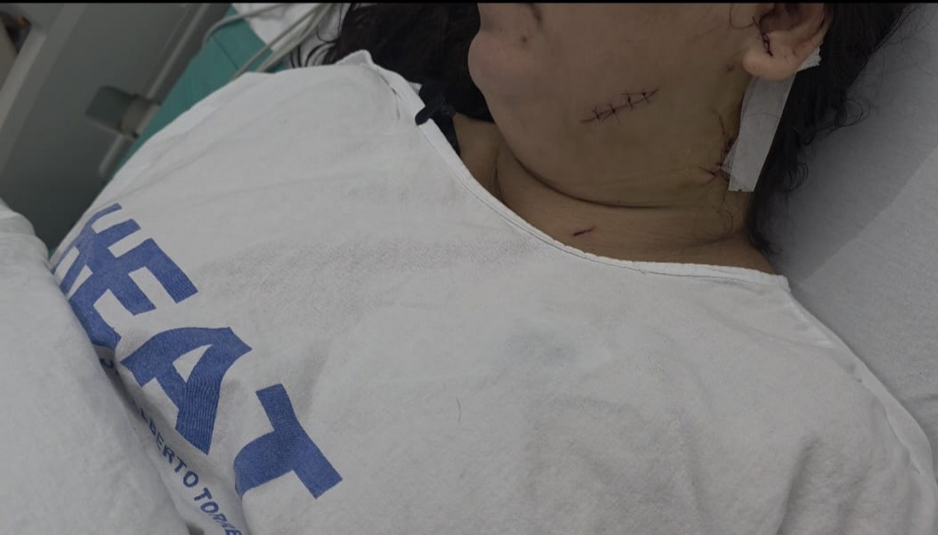 Empresária é esfaqueada pelo marido e é socorrida pela amante do suspeito