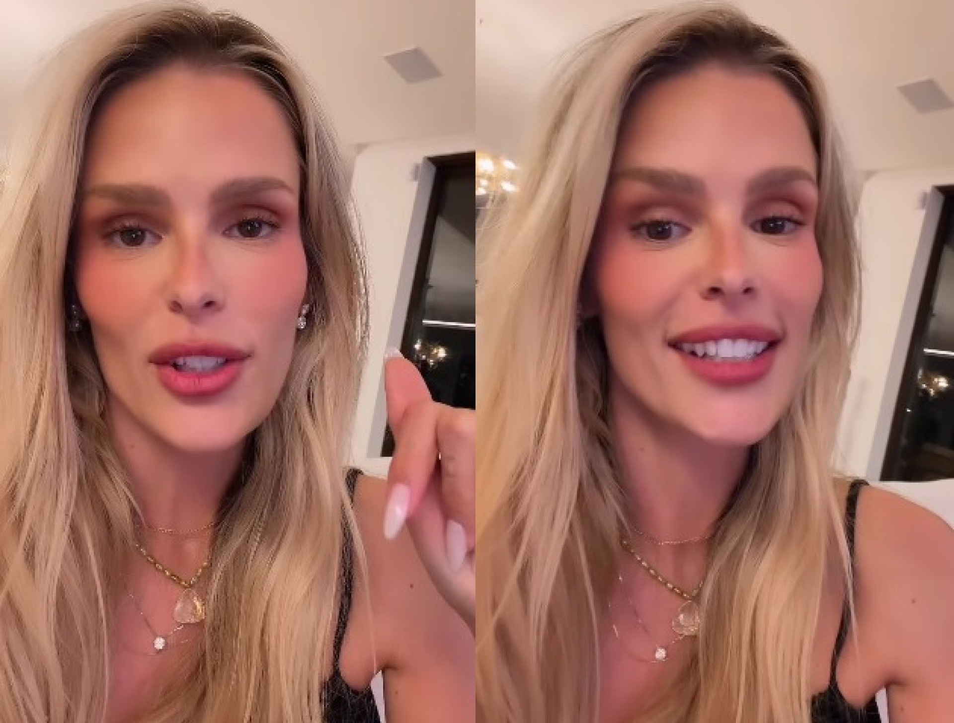 Yasmin Brunet 'descobriu' lipedema de maneira curiosa  - Reprodução/Instagram 