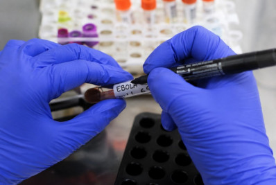 Especialistas avaliam se existe possibilidade de pandemia de ebola