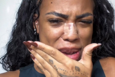 Vídeo: Marvvila realiza cirurgia para remoção do sexto dedo