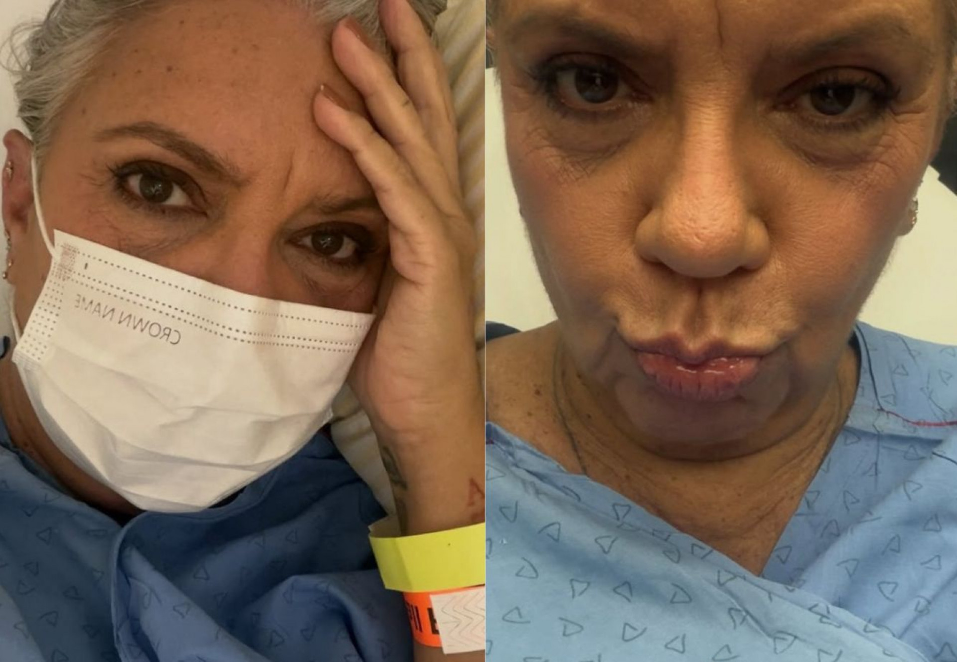 Astrid Fontenelle vai parar no pronto-socorro após inflamação causada por espinha - Reprodução / Instagram