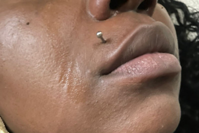 Modelo é vítima de agressão física e ofensas racistas em elevador no Centro