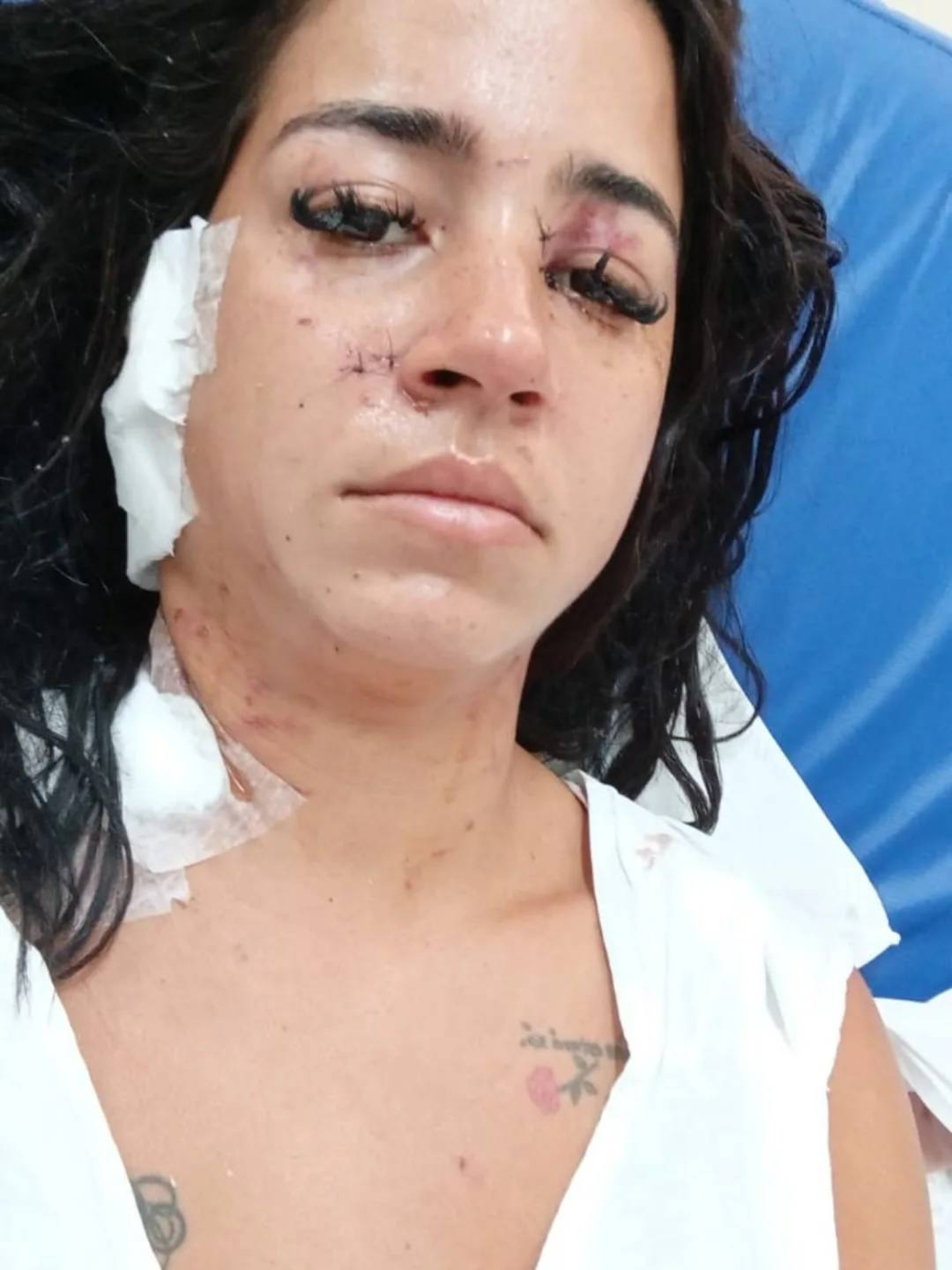 Hayanna foi esfaqueada no domingo (31) - Rede Social