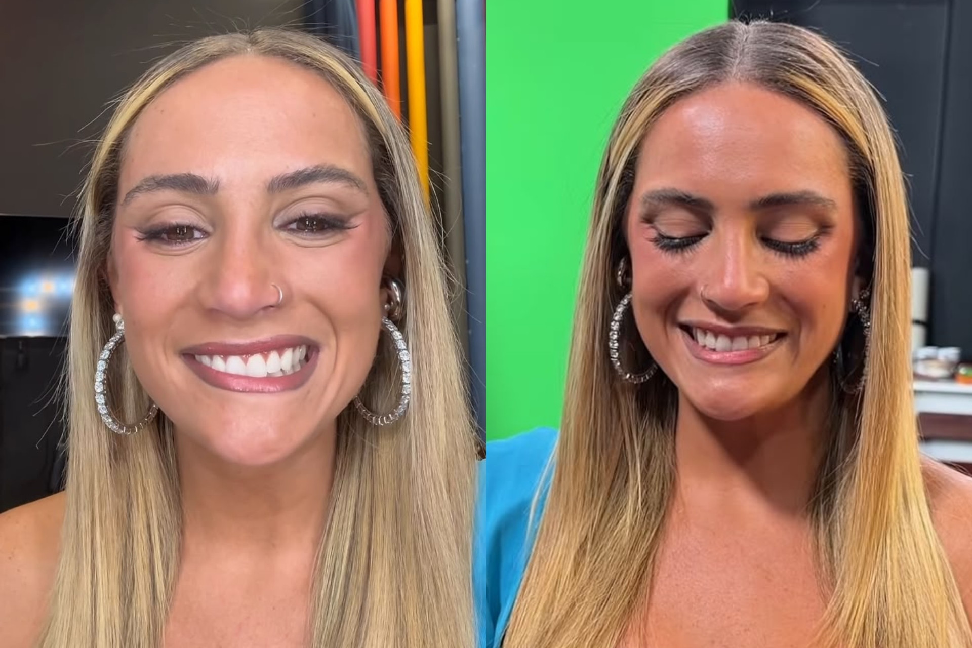 Luisa P&eacute;riss&eacute; mostra susto com paralisia facial durante grava&ccedil;&atilde;o - Reprodu&ccedil;&atilde;o / Instagram