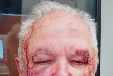 Polícia Civil apura denúncia de agressão contra idoso em Copacabana