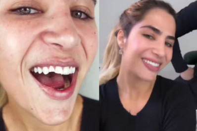 Filha de Leonardo mostra novo sorriso após quebrar dentes em tombo