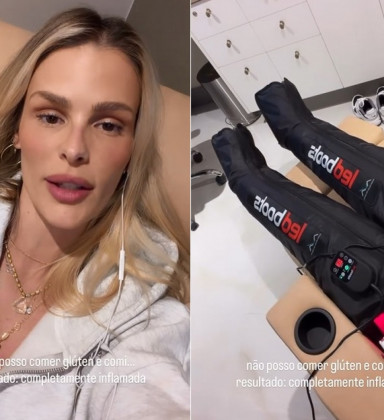 Yasmin Brunet desabafa sobre crise de lipedema: 'Fiz tudo errado'